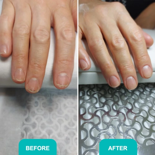 Oil_for_damaged_nail_plate-2.webp